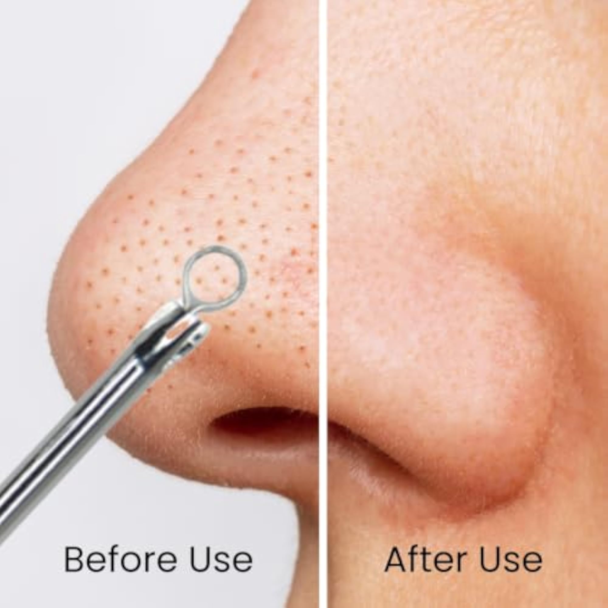Midazzle Stainless Steel Blackhead Remover with Organic Loofah